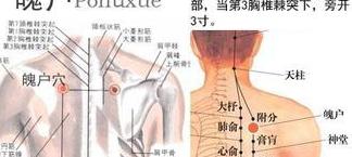 山楂陈皮 中医解析打呼噜原因：肺功能异常与日常养生误区